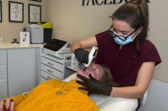 dermapen-microneedling