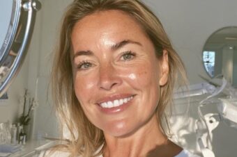 seventy-hyal-skin-booster Seventy Hyal 2000 skin booster results from Facebox London